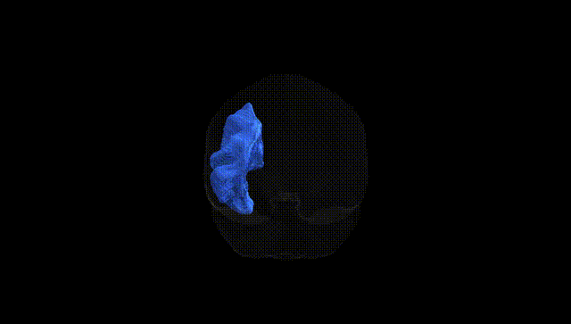 Full Brain Black