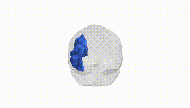 Full Brain White