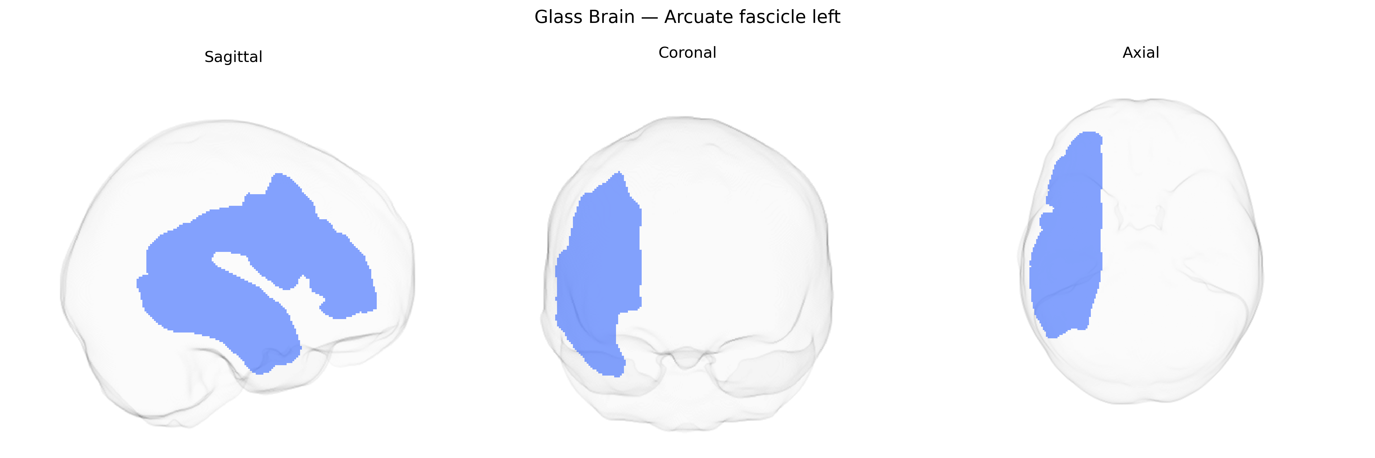 Triplanar Ghost Brain