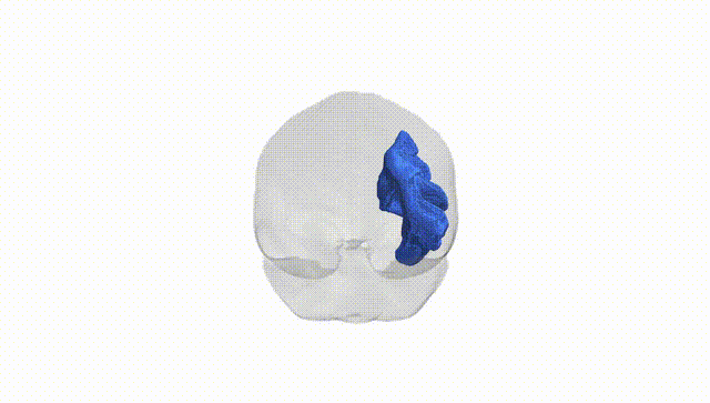 Full Brain White