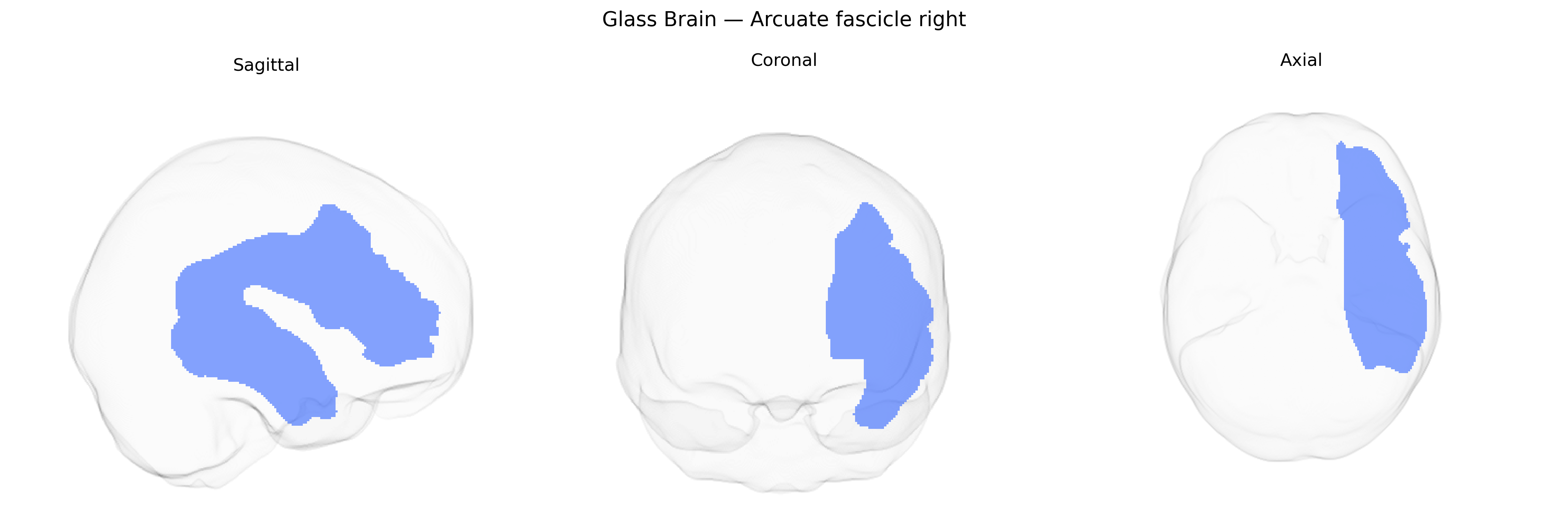 Triplanar Ghost Brain