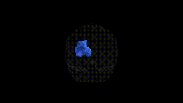Full Brain Black