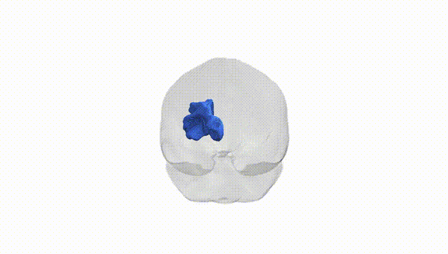 Full Brain White
