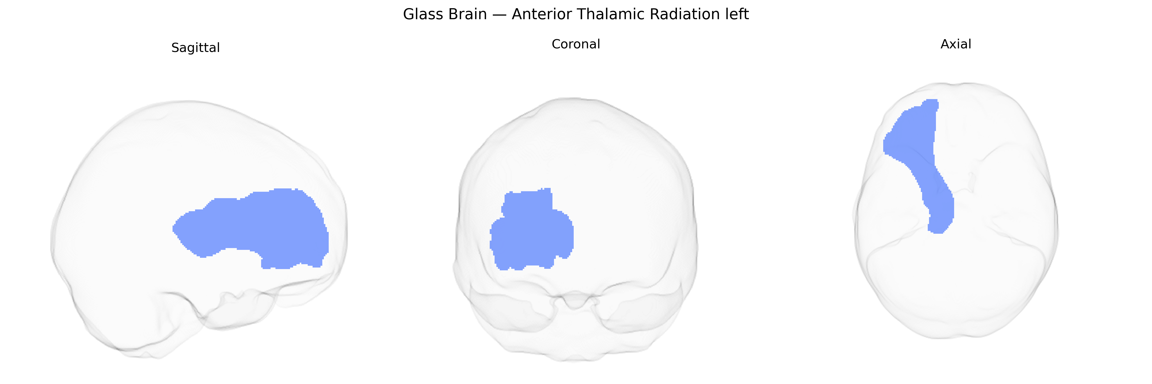 Triplanar Ghost Brain