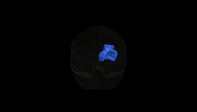 Full Brain Black