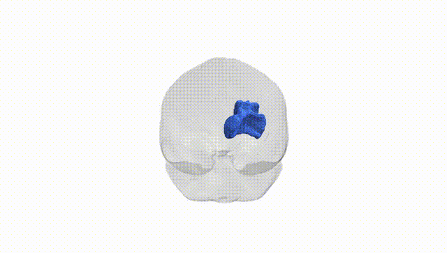 Full Brain White