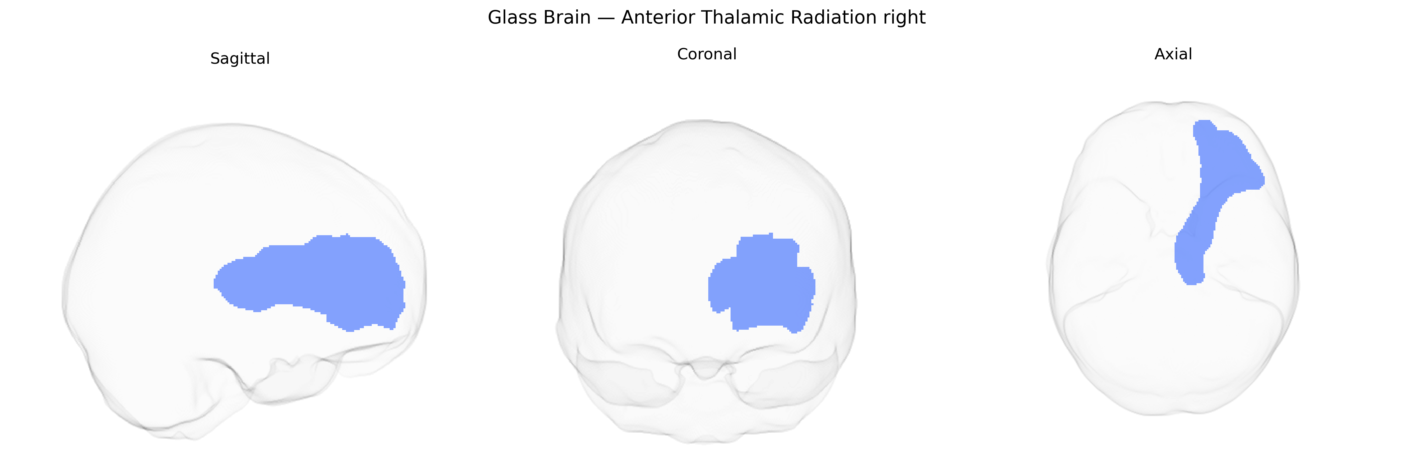 Triplanar Ghost Brain