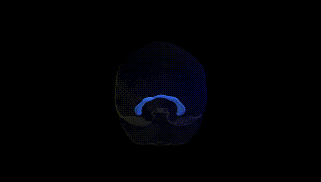 Full Brain Black