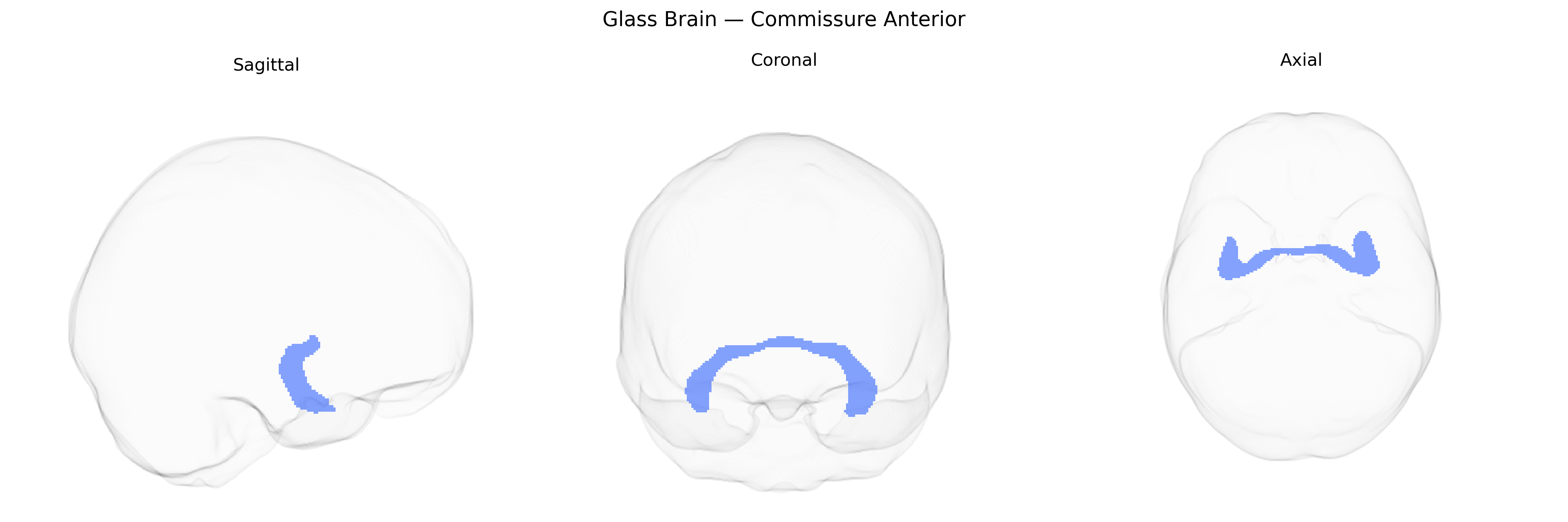 Triplanar Ghost Brain
