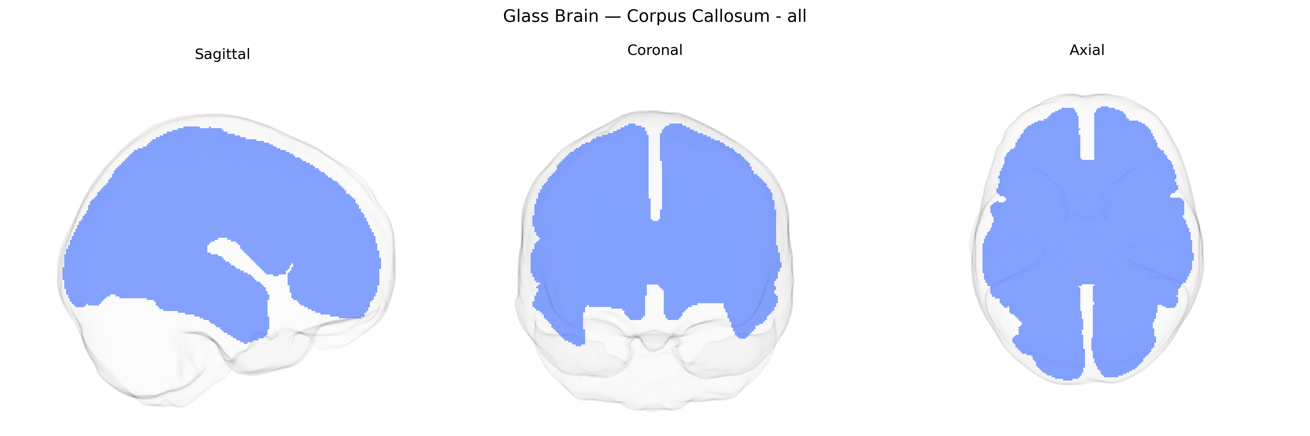 Triplanar Ghost Brain