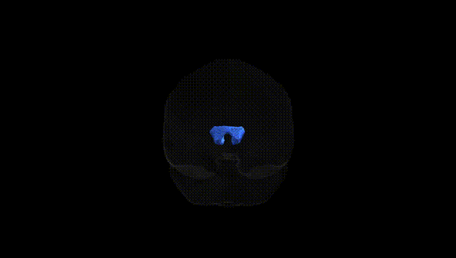 Full Brain Black