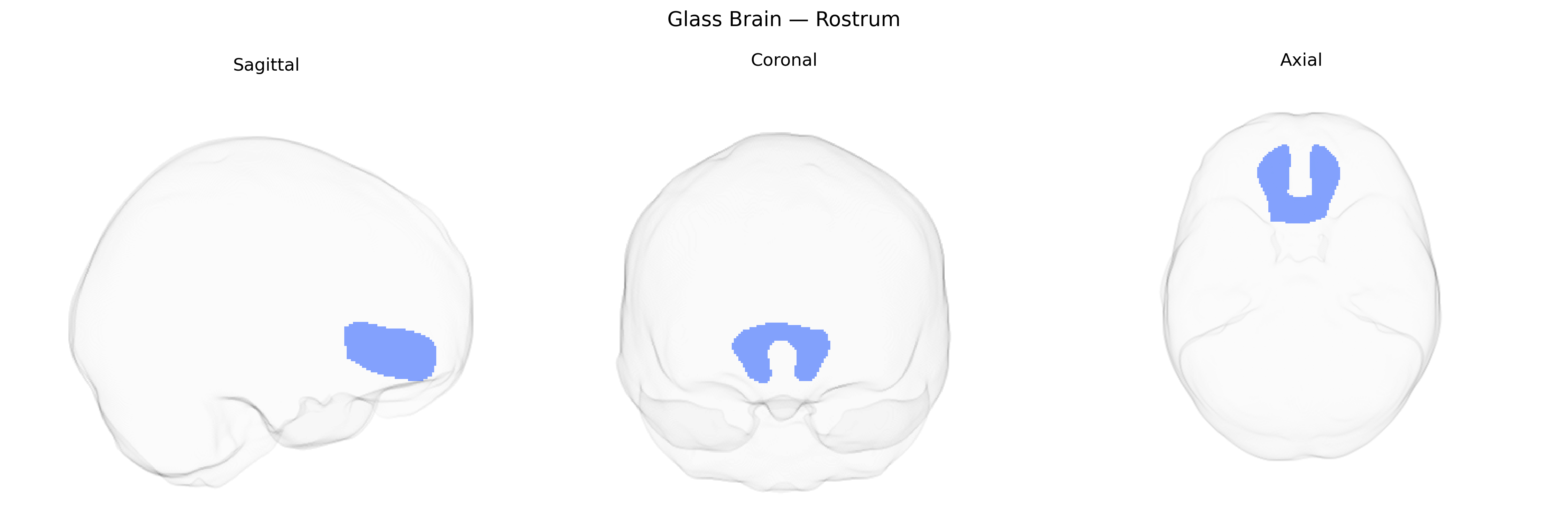 Triplanar Ghost Brain
