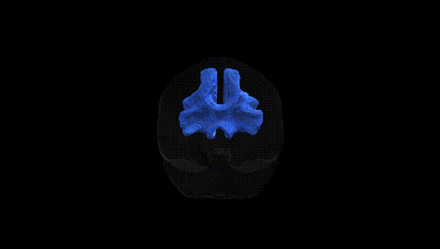Full Brain Black