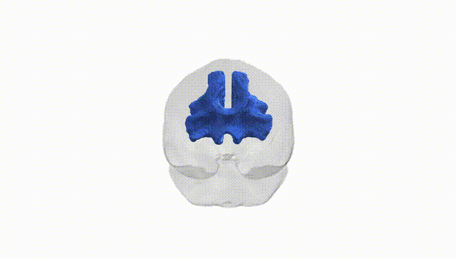 Full Brain White