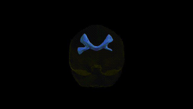 Full Brain Black