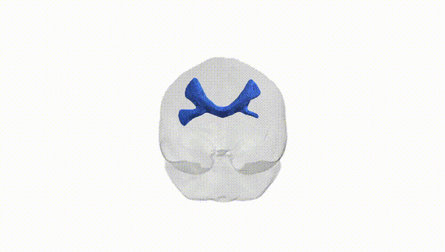 Full Brain White