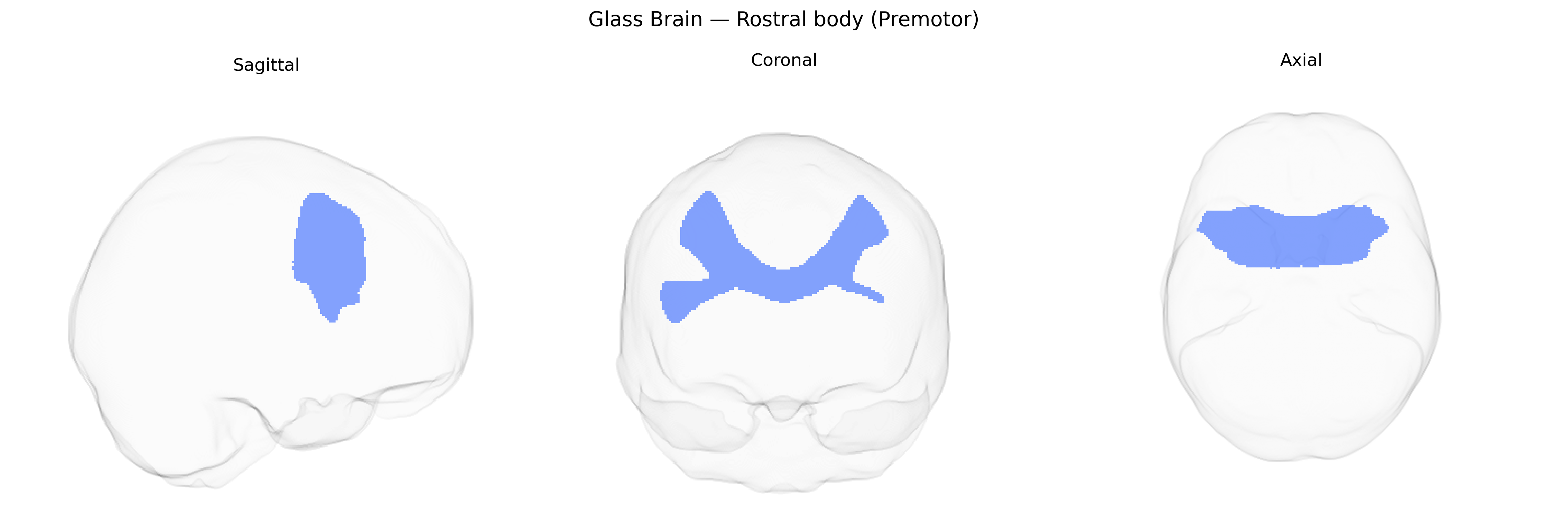 Triplanar Ghost Brain