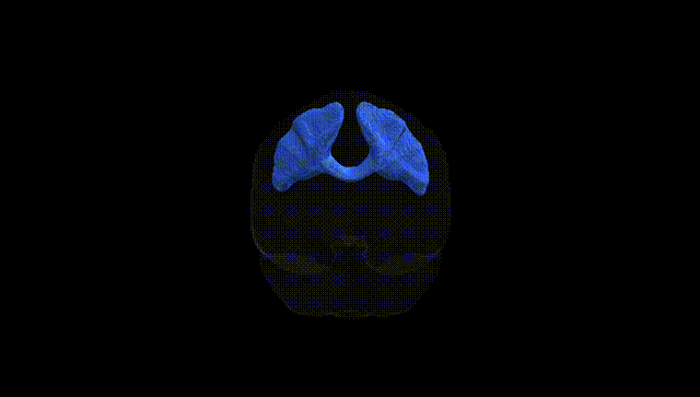 Full Brain Black