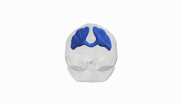 Full Brain White