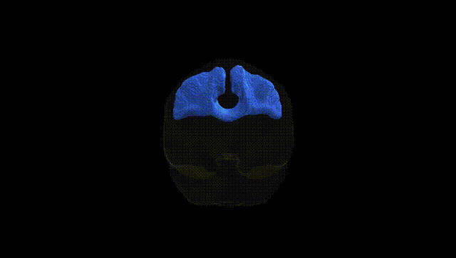 Full Brain Black