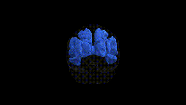 Full Brain Black