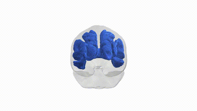 Full Brain White