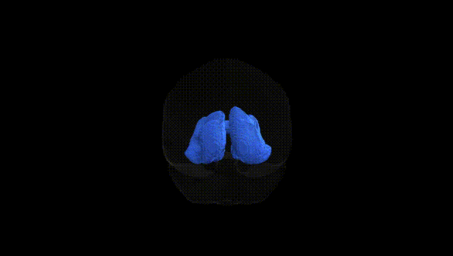 Full Brain Black