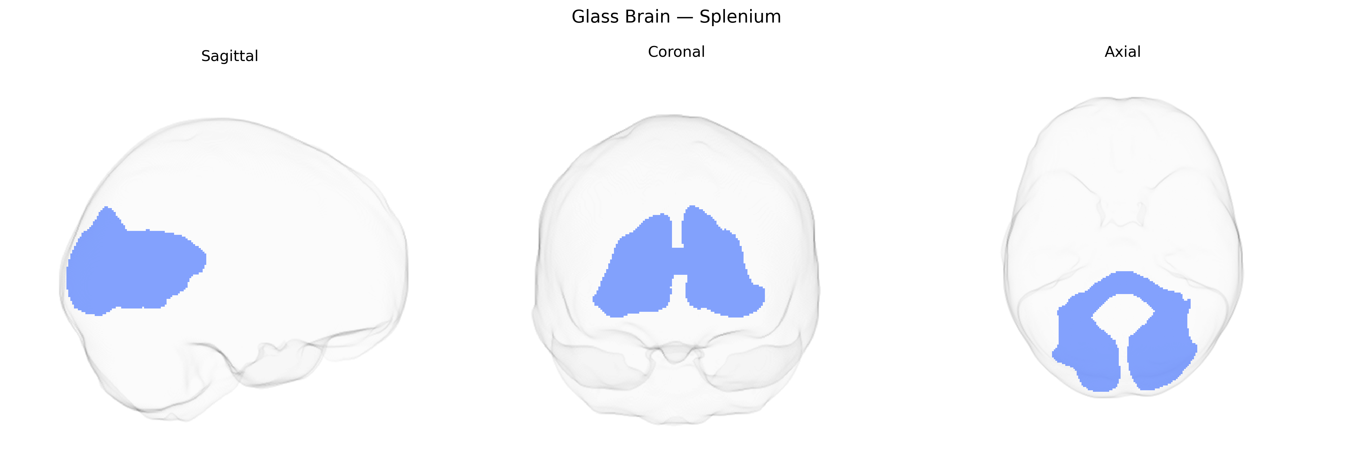 Triplanar Ghost Brain
