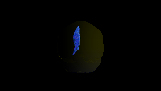 Full Brain Black