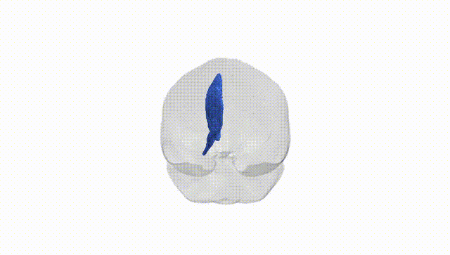 Full Brain White