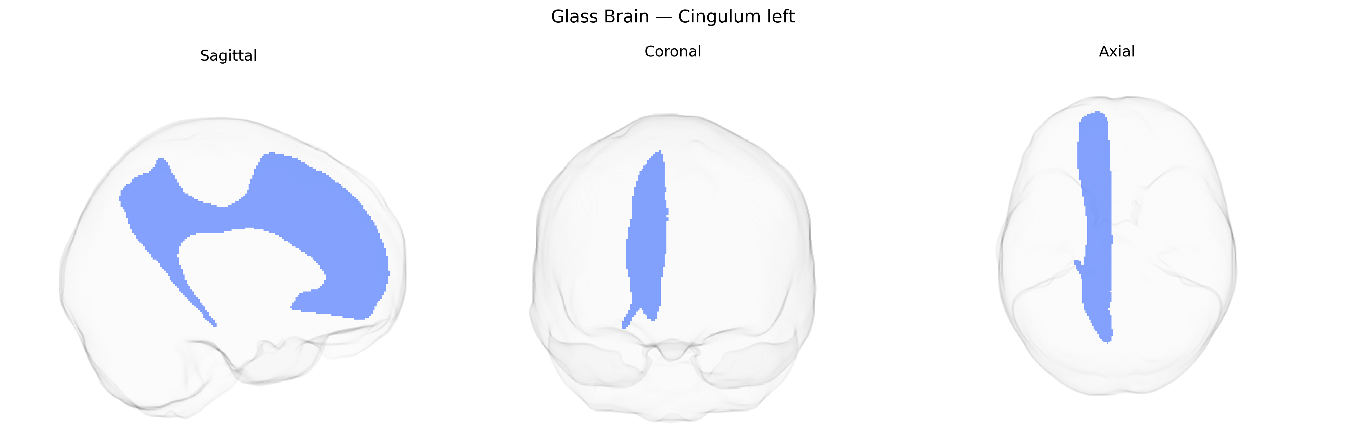Triplanar Ghost Brain