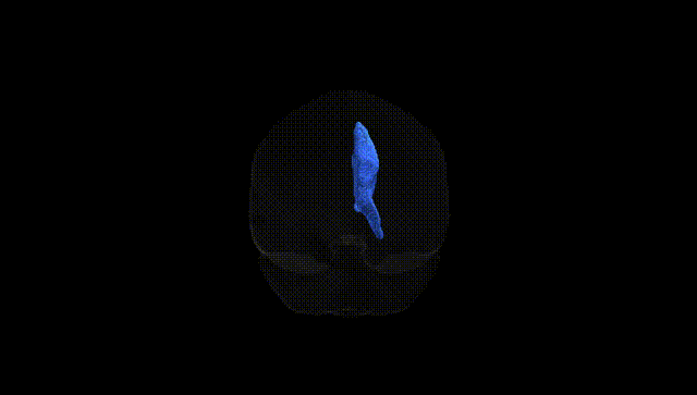 Full Brain Black