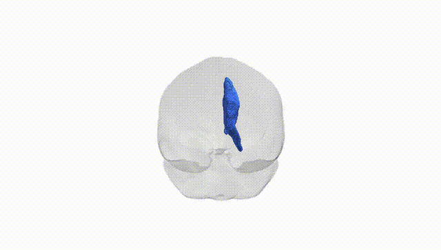 Full Brain White
