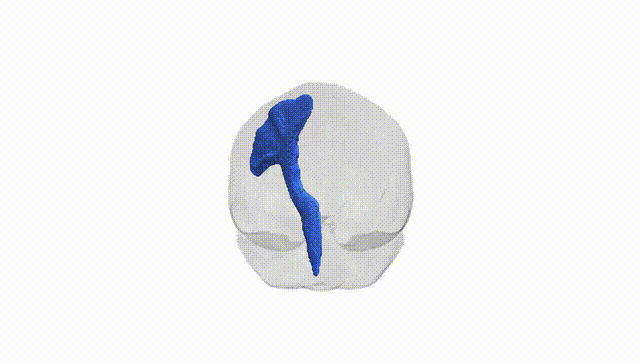 Full Brain White