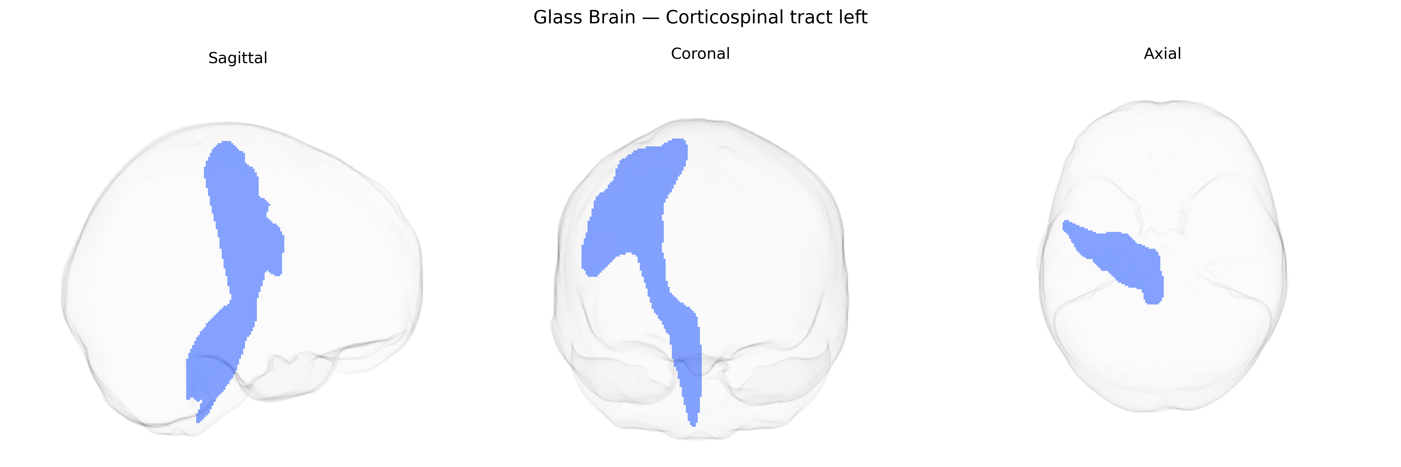 Triplanar Ghost Brain