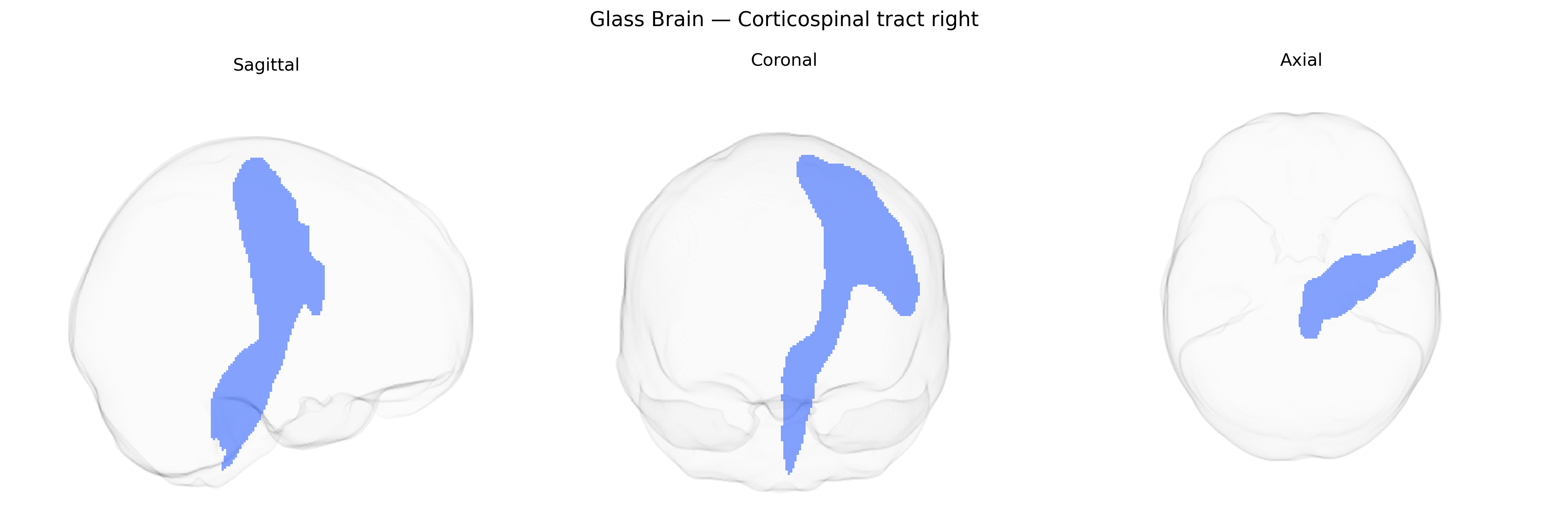 Triplanar Ghost Brain