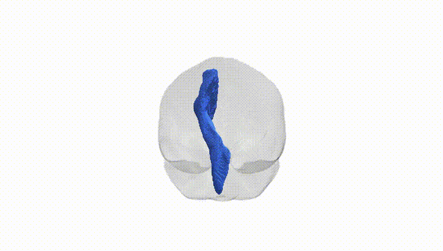 Full Brain White