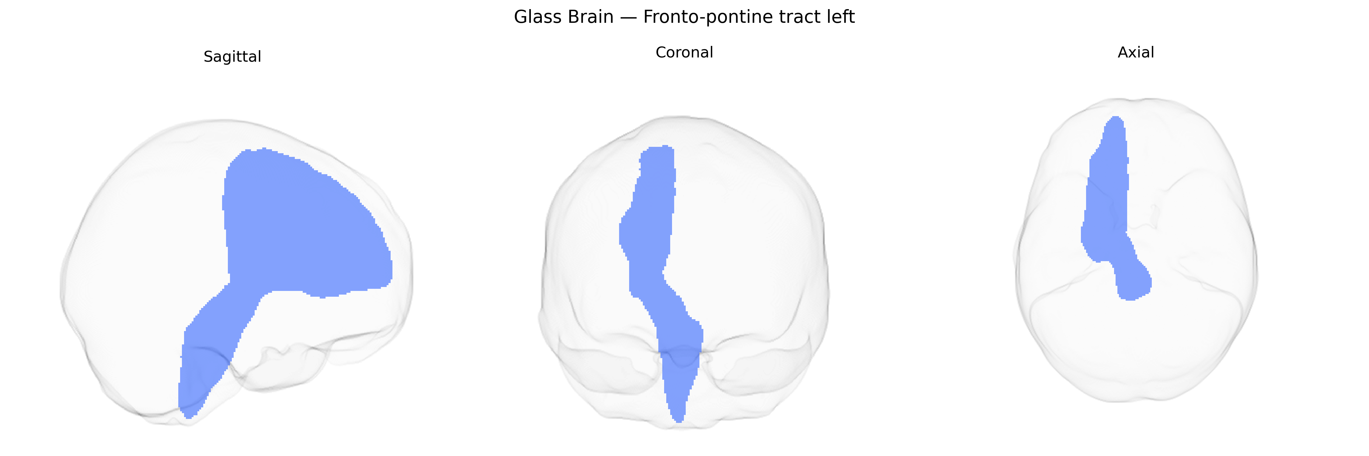 Triplanar Ghost Brain