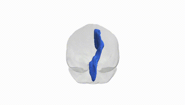 Full Brain White
