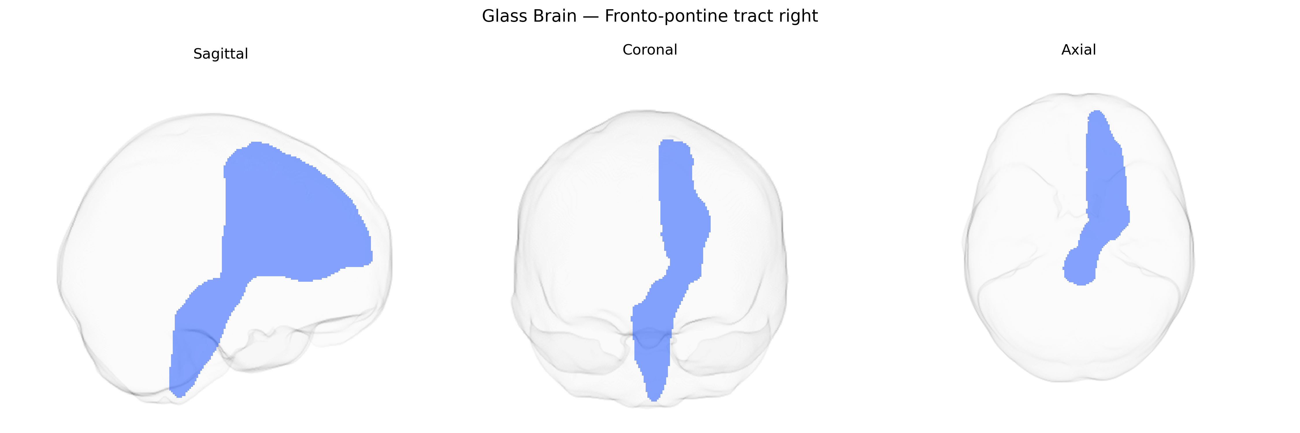 Triplanar Ghost Brain