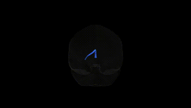 Full Brain Black