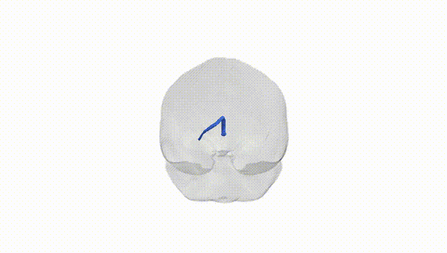 Full Brain White