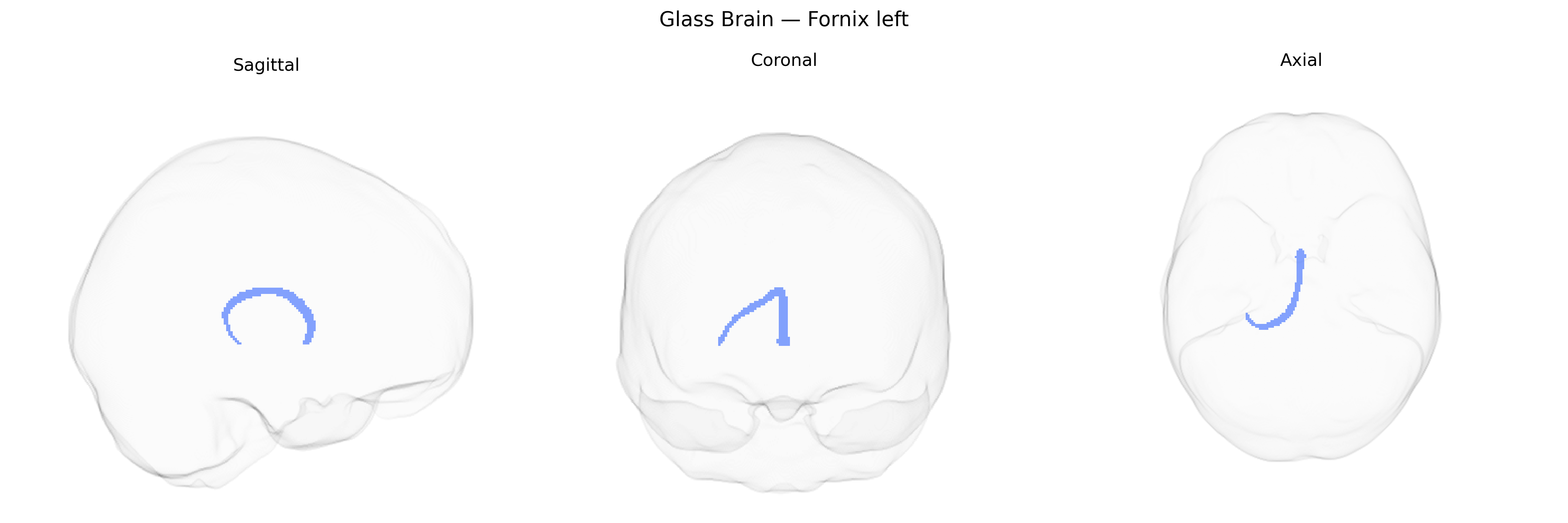 Triplanar Ghost Brain
