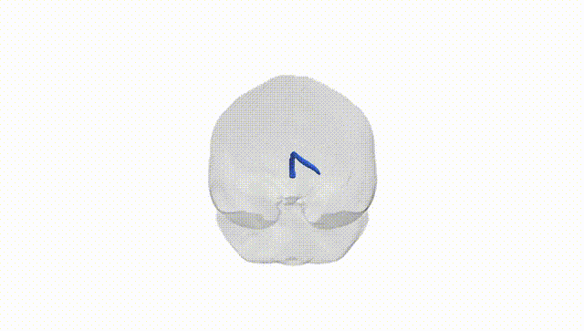 Full Brain White