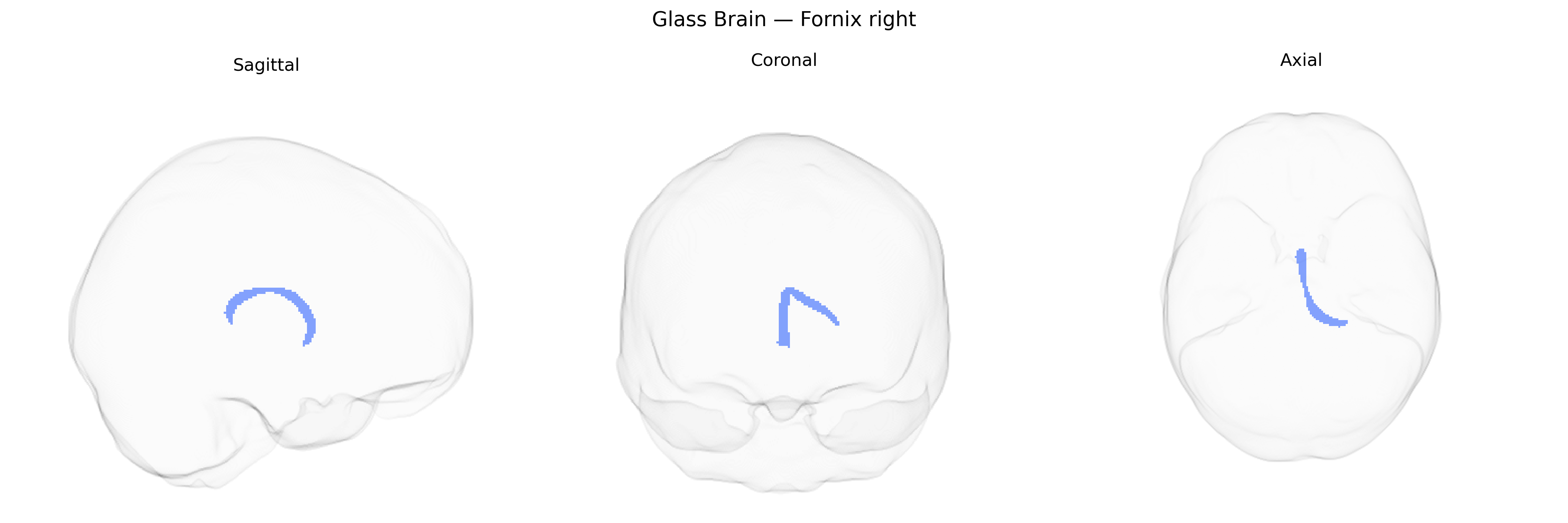 Triplanar Ghost Brain