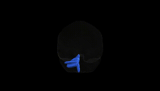 Full Brain Black