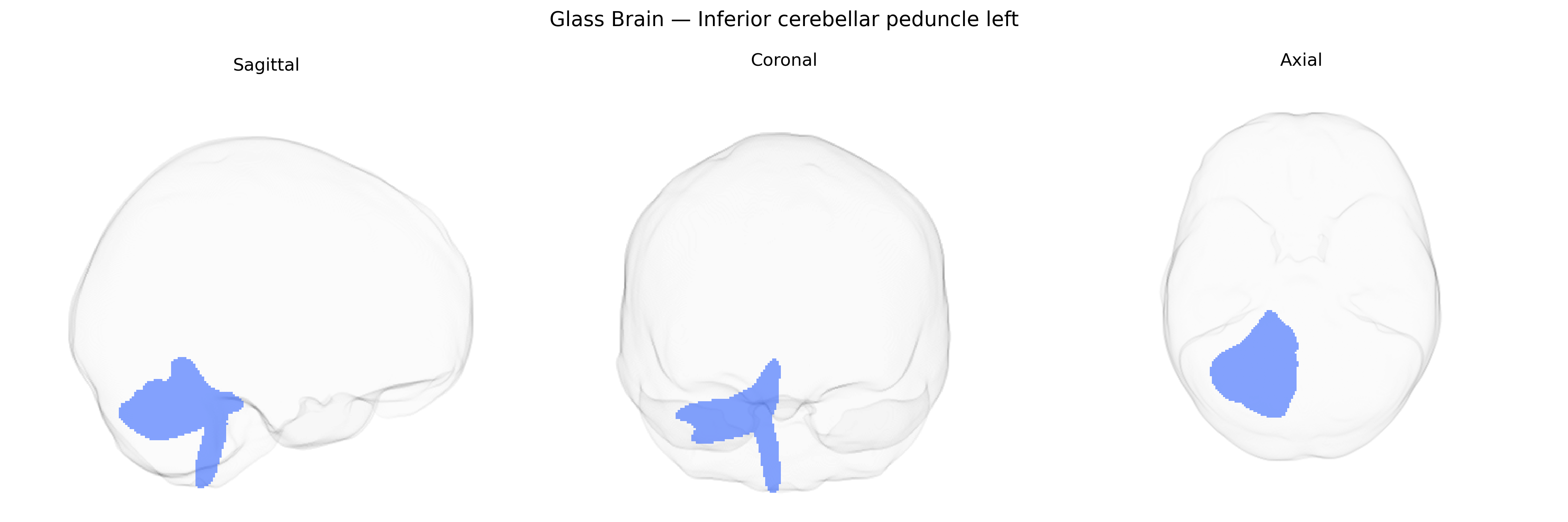 Triplanar Ghost Brain