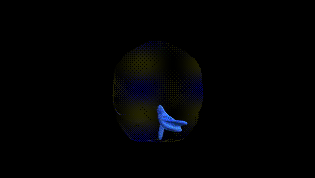 Full Brain Black