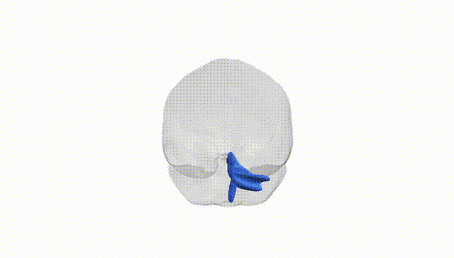 Full Brain White