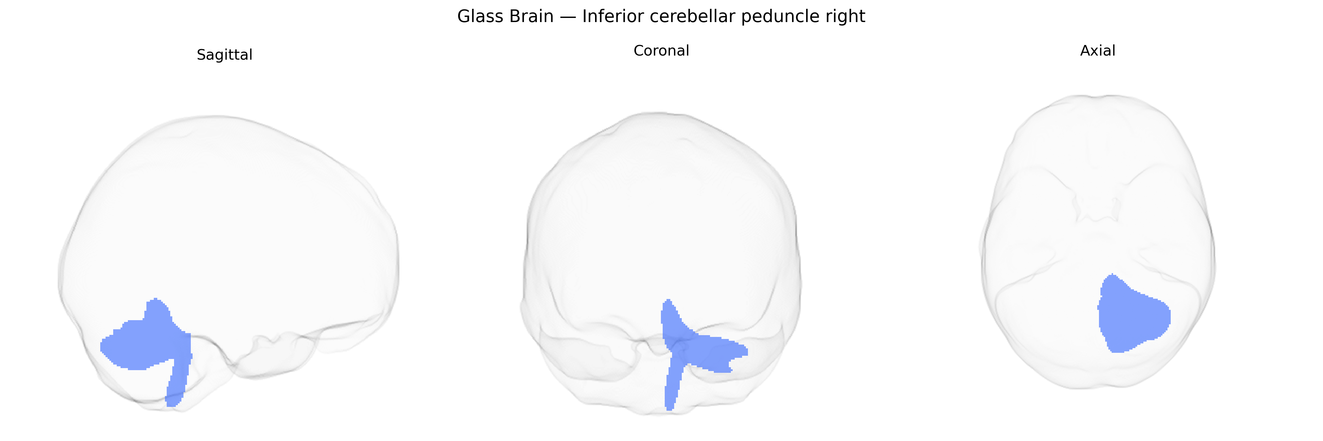 Triplanar Ghost Brain
